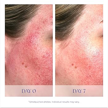 Pro-Heal Serum Advance+