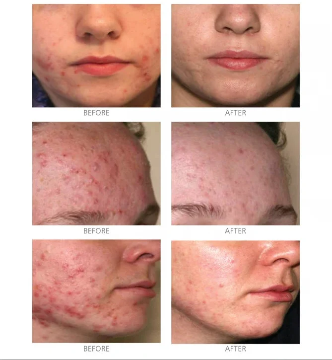 Active Serum