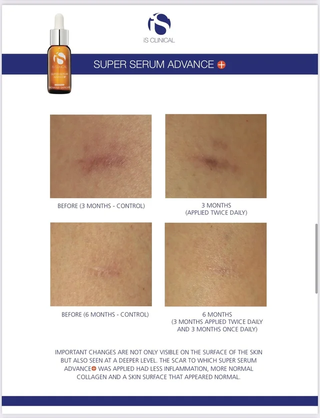 Super Serum Advance+